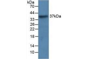 Detection of Recombinant LRG1, Human using Monoclonal Antibody to Leucine Rich Alpha-2-Glycoprotein 1 (LRG1) (LRG1 antibody  (AA 37-340))