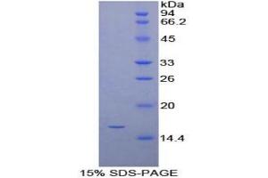 SDS-PAGE analysis of Mouse Synuclein gamma Protein. (SNCG Protein)