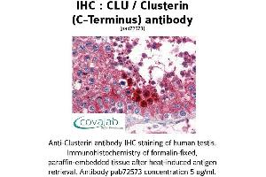 Image no. 1 for anti-Clusterin (CLU) (C-Term) antibody (ABIN1733163) (Clusterin antibody  (C-Term))
