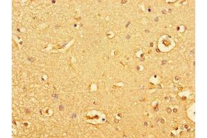 Immunohistochemistry of paraffin-embedded human brain tissue using ABIN7154928 at dilution of 1:100 (GUCY2C antibody  (AA 636-891))