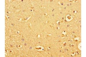 Immunohistochemistry of paraffin-embedded human brain tissue using ABIN7154928 at dilution of 1:100 (GUCY2C antibody  (AA 636-891))