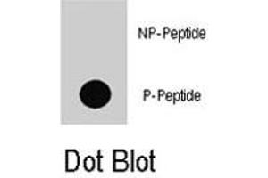 Dot blot analysis of BRAF (phospho T598) polyclonal antibody  on nitrocellulose membrane.