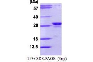 SDS-PAGE (SDS) image for Proteasome (Prosome, Macropain) Subunit, beta Type 10 (PSMB10) (AA 40-273) protein (His tag) (ABIN666617) (PSMB10 Protein (AA 40-273) (His tag))