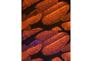 Immunofluorescence analysis of mouse skeletal muscle using α-Actin-1  Rabbit mAb (ABIN3015986, ABIN3015987, ABIN1680683 and ABIN1680684) at dilution of 1:100 (40x lens). (Actin antibody)