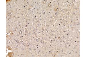 ABIN6265035 and ABIN6279859 at 1/100 staining rat brain tissue by IHC-P.