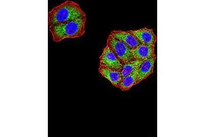Immunocytochemistry (ICC) image for anti-Lysine (K)-Specific Demethylase 3A (KDM3A) (AA 311-445) antibody (ABIN5542630)
