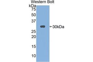 Western blot analysis of the recombinant protein. (IL2RG antibody  (AA 23-263))