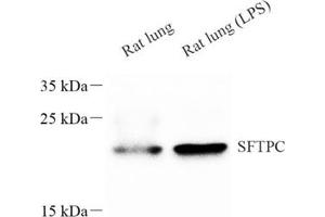 Western blot analysis of sftpc (ABIN7075216),at dilution of 1: 600 (Prosurfactant Protein C antibody)