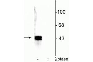 Western blot of human T47D cell lysate showing specific immunolabeling of ~42-44 kDa ERK/MAPK protein phosphorylated at Thr202/Tyr204 in the first lane (-). (MAPK1/2 (pThr202), (pTyr204) antibody)