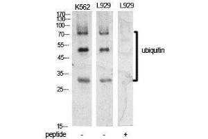 Western Blotting (WB) image for anti-Ubiquitin (Ubiquitin) (Internal Region) antibody (ABIN3181396) (Ubiquitin antibody  (Internal Region))