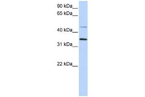 WB Suggested Anti-CLN6 Antibody Titration:  0.