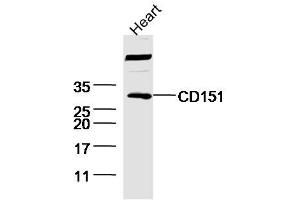 Mouse heart lysates probed with Rabbit Anti-CD151 Polyclonal Antibody, Unconjugated  at 1:300 overnight at 4˚C. (CD151 antibody  (AA 101-200))