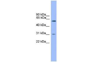 Western Blot showing PCSK2 antibody used at a concentration of 1-2 ug/ml to detect its target protein. (PCSK2 antibody  (Middle Region))