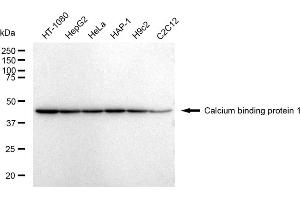 anti-Calcium Binding Protein 1 (CABP1) antibody