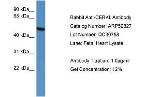 WB Suggested Anti-CERKL  Antibody Titration: 0. (CERKL antibody  (C-Term))
