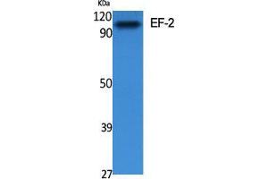 Western Blot (WB) analysis of specific cells using EF-2 Polyclonal Antibody. (EEF2 antibody  (Ser311))