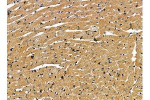 ABIN7095381 and ABIN7099438 at 1/100 staining rat heart tissue by IHC-P. (Endogenous retrovirus group 3 member 1 Env polyprotein (ERV3-1) antibody)