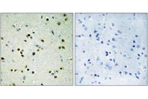 Immunohistochemistry analysis of paraffin-embedded human brain, using JHD3B Antibody. (JHD3B antibody  (AA 351-400))