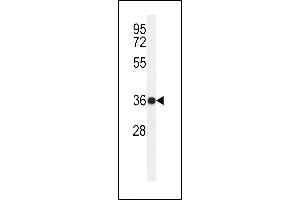 Western blot analysis of R6G Antibody (N-term) (ABIN650946 and ABIN2840004) in ZR-75-1 cell line lysates (35 μg/lane). (PARD6G antibody  (N-Term))