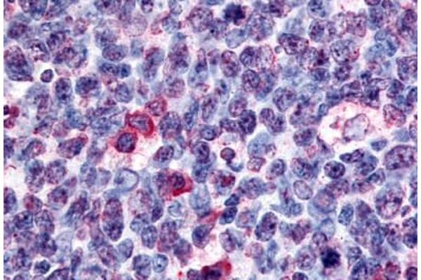 GPR146 antibody  (Cytoplasmic Domain)