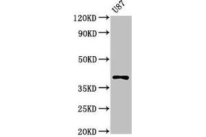 Western Blot Positive WB detected in: U87 whole cell lysate All lanes: OPN1SW antibody at 3 μg/mL Secondary Goat polyclonal to rabbit IgG at 1/50000 dilution Predicted band size: 40 kDa Observed band size: 40 kDa (OPN1SW antibody  (AA 307-348))