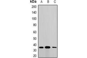 Western blot analysis of Metaxin-1 expression in A549 (A), SKOV3 (B), mouse liver (C) whole cell lysates. (Metaxin 1 antibody)