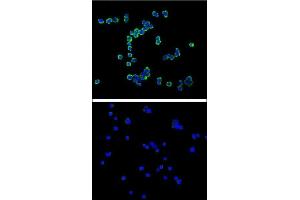 Confocal immunofluorescent analysis of C antibody  with R cell (above) compared with Jurkat as negative cell line (below).
