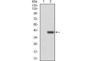 Western blot analysis using SELL mAb against HEK293 (1) and SELL (AA:83-186)-hIgGFc transfected HEK293 (2) cell lysate. (L-Selectin antibody  (AA 83-186))