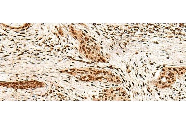 PAFAH1B2 antibody