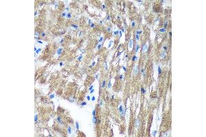 Immunohistochemistry of paraffin-embedded Mouse heart using TIMMDC1 Rabbit pAb (ABIN7270929) at dilution of 1:100 (40x lens). (TIMMDC1 antibody  (AA 206-285))