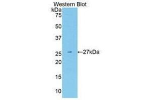 Western Blotting (WB) image for anti-Neuregulin 1 (NRG1) (AA 20-242) antibody (ABIN1175117) (Neuregulin 1 antibody  (AA 20-242))