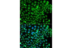 Immunofluorescence analysis of A549 cells using SUMO4 antibody. (SUMO4 antibody  (AA 1-95))