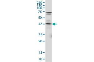 PAX5 monoclonal antibody (M01), clone 8F9. (PAX5 antibody  (AA 192-301))