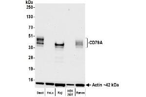 Western Blotting (WB) image for anti-B-cell antigen receptor complex-associated protein alpha chain (CD79A) (AA 33-143) antibody (ABIN7453962) (Recombinant CD79a antibody  (AA 33-143))