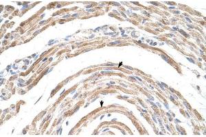 Immunohistochemical staining (Formalin-fixed paraffin-embedded sections) of human muscle with CPSF6 polyclonal antibody . (CPSF6 antibody  (AA 261-310))