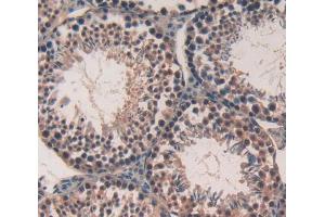 Used in DAB staining on fromalin fixed paraffin- embedded Kidney tissue (CABIN1 antibody  (AA 11-289))