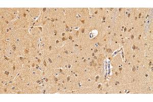 Detection of MAP1LC3a in Human Cerebrum Tissue using Polyclonal Antibody to Microtubule Associated Protein 1 Light Chain 3 Alpha (MAP1LC3a) (MAP1LC3A antibody  (AA 1-120))