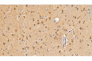 Immunohistochemistry (IHC) image for anti-Microtubule-Associated Protein 1 Light Chain 3 alpha (MAP1LC3A) (AA 1-120) antibody (ABIN7441658)