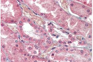 Kidney, Human: Formalin-Fixed, Paraffin-Embedded (FFPE) (PKD1 antibody  (AA 4289-4300))