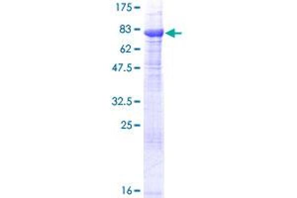 FANCC Protein (AA 1-558) (GST tag)