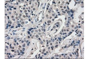 Image no. 3 for anti-Budding Uninhibited By Benzimidazoles 1 Homolog beta (Yeast) (BUB1B) antibody (ABIN1496995) (BUB1B antibody)