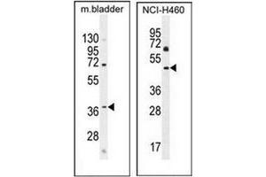 Western blot analysis in mouse bladder tissue (left) and NCI-H460 cell line (right) lysates  (35ug/lane) using CL029 antibody (N-term) Cat.