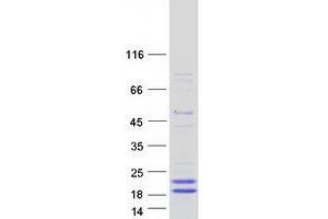 Validation with Western Blot (PLA2G10 Protein (Myc-DYKDDDDK Tag))