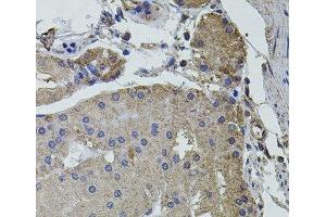 Immunohistochemistry of paraffin-embedded Human stomach using UBE2S Polyclonal Antibody at dilution of 1:100 (40x lens). (UBE2S antibody)