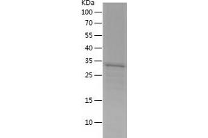 Western Blotting (WB) image for KH-Type Splicing Regulatory Protein (KHSRP) (AA 601-708) protein (His-IF2DI Tag) (ABIN7282834) (KHSRP Protein (AA 601-708) (His-IF2DI Tag))