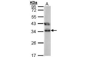 WB Image Sample (30 ug of whole cell lysate) A: 293T 12% SDS PAGE antibody diluted at 1:1000 (TTC1 antibody)