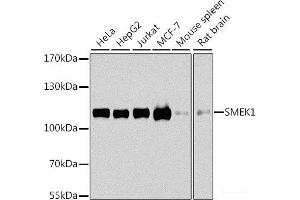 Western blot analysis of extracts of various cell lines using SMEK1 Polyclonal Antibody at dilution of 1:1000. (SMEK1 antibody)