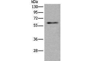 Western blot analysis of Mouse testis tissue lysate using SCP2 Polyclonal Antibody at dilution of 1:350 (SCP2 antibody)