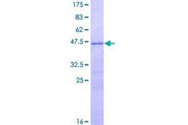 RSPO2 Protein (AA 1-176) (GST tag)