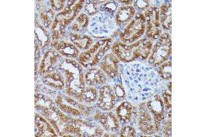 Immunohistochemistry of paraffin-embedded mouse kidney using DDX6 antibody (ABIN7266704) at dilution of 1:100 (40x lens). (DDX6 antibody  (C-Term))